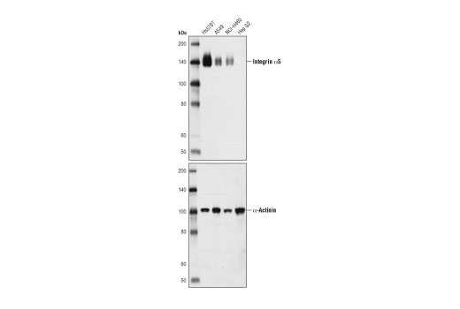 Integrin α5 (D7B7G) Rabbit mAb