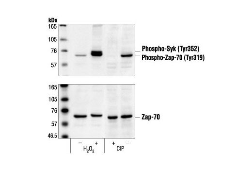 Phospho-Zap-70 (Tyr319)/Syk (Tyr352) Antibody
