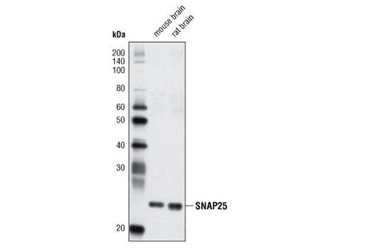SNAP25 (D7B4) Rabbit mAb