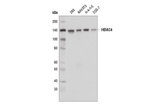 HDAC4 (D8T3Q) Rabbit mAb