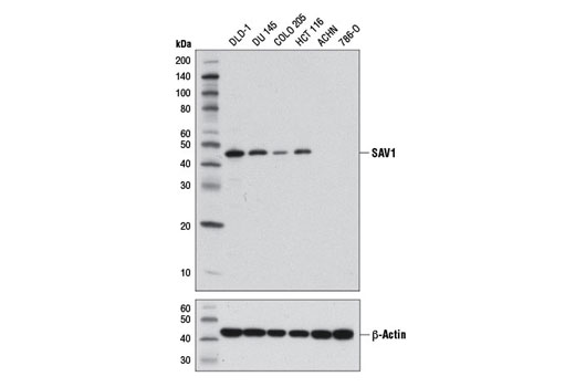SAV1 (D6M6X) Rabbit mAb