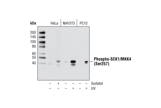 Phospho-SEK1/MKK4 (Ser257) (C36C11) Rabbit mAb