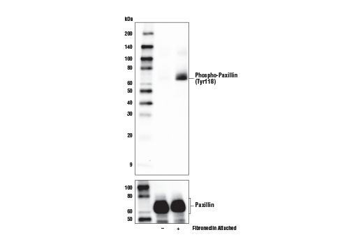 Phospho-Paxillin (Tyr118) (E9U9F) Rabbit mAb