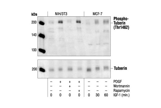 Tuberin/TSC2 Antibody