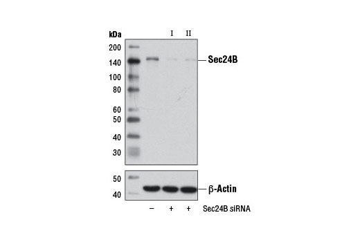 Sec24B (D7D6S) Rabbit mAb