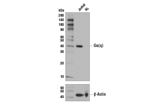 Gα(q) (D5V1B) Rabbit mAb