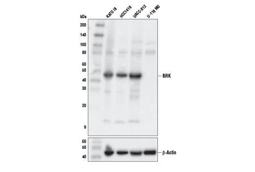 PTK6/BRK (D4O2D) Rabbit mAb