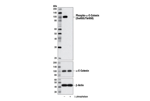 Phospho-α-E-Catenin (Ser655/Thr658) Antibody