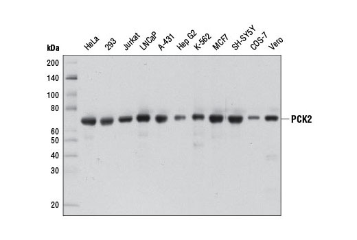 PCK2 (D3E11) Rabbit mAb