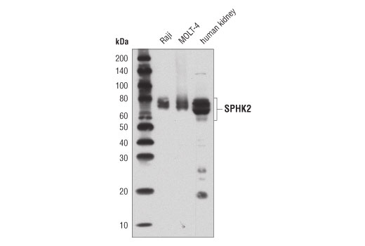 SPHK2 (D2V3G) Rabbit mAb