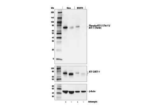 Phospho-ATF-2 (Thr71)/ATF-7 (Thr53) (E4A5G) XPRabbit mAb