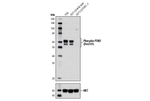 PTEN and PDK1 Antibody Sampler Kit II