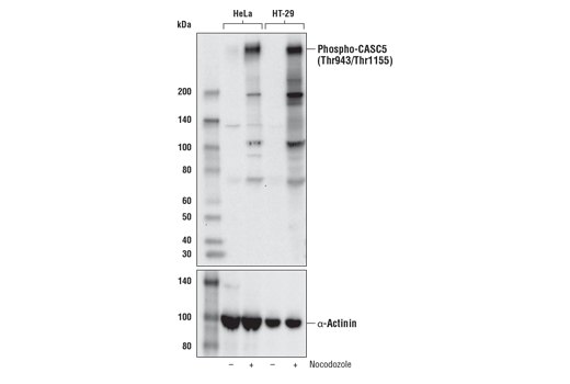 Phospho-CASC5 (Thr943/Thr1155) (D8D4N) Rabbit mAb
