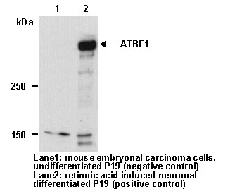 Anti-ATBF1 (AT-6) pAb