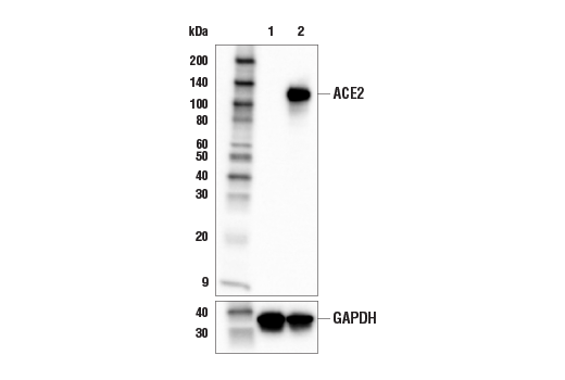 ACE2 (E5O6J) XP&lt;lt/&gt;sup&amp;gt; &lt;lt/&gt;/sup&amp;gt; Rabbit mAb