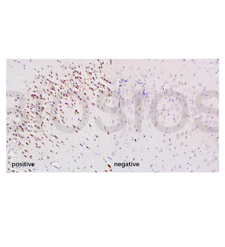 8-羟基脱氧鸟苷/DNA/RNA Damage抗体