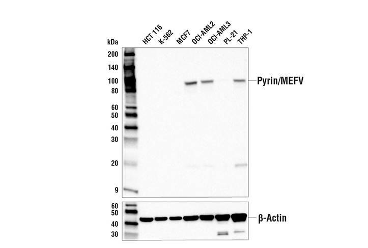 Pyrin/MEFV (E2E8U) Rabbit Monoclonal Antibody