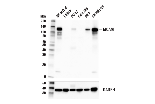 MCAM (E3F3E) XP&lt;lt/&gt;sup&amp;gt; &lt;lt/&gt;/sup&amp;gt;Rabbit mAb