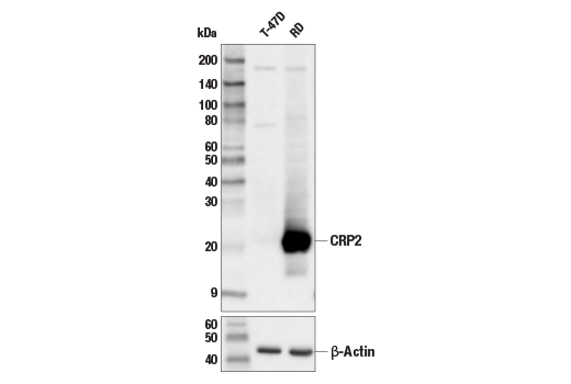 CRP2 (E8R5N) Rabbit mAb