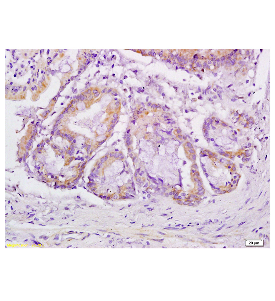 血管内皮细胞生长因子受体3抗体