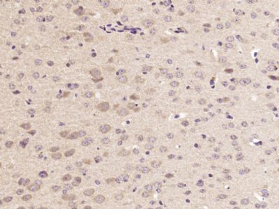 乙酰胆碱酯酶抗体