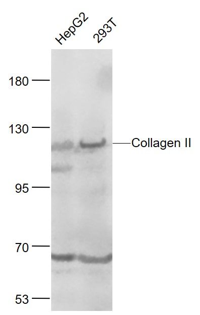 Ⅱ型胶原a1蛋白/软骨钙素抗体