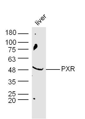 孤儿核受体PAR1抗体