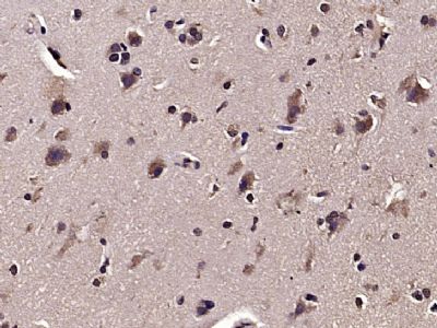 磷酸化原癌基因蛋白18抗体