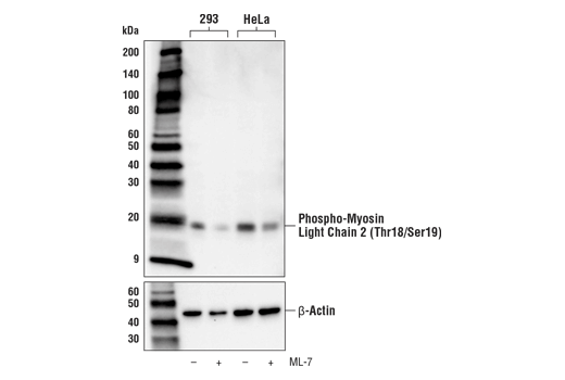 Phospho-Myosin Light Chain 2 (Thr18/Ser19) (E2J8F) Rabbit mAb