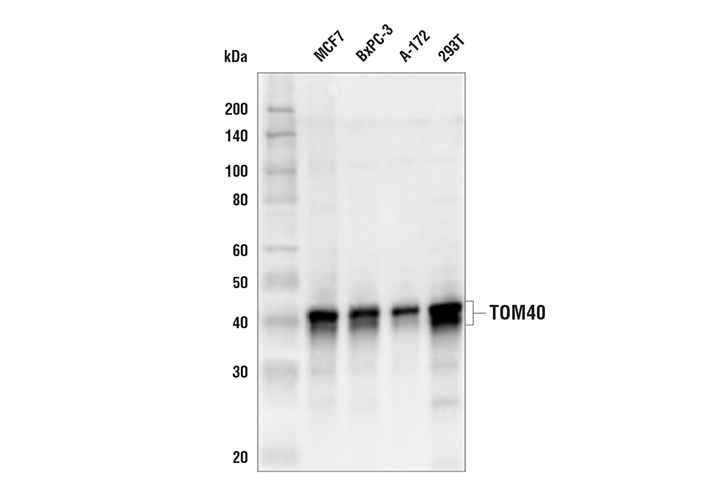 TOM40 (E6Q3Z) Rabbit mAb