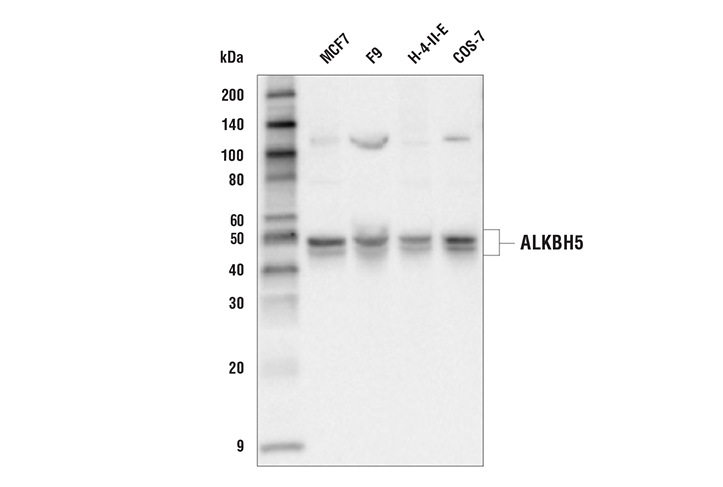 ALKBH5 (E5Y7C) Rabbit mAb