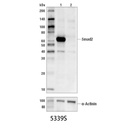 Smad2 (D43B4) XP Rabbit mAb