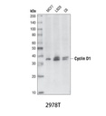 Cyclin D1 (92G2) Rabbit mAb