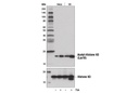 Acetyl-Histone H3 Antibody Sampler Kit