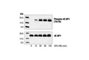 Phospho-4E-BP1 (Thr70) Antibody