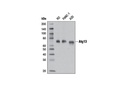 ULK1 Substrate Antibody Sampler Kit