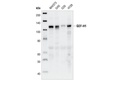 GEF-H1 (55B6) Rabbit mAb