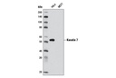 Cytokeratin Antibody Sampler Kit