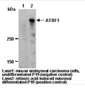 Anti-ATBF1 (D1-120) pAb